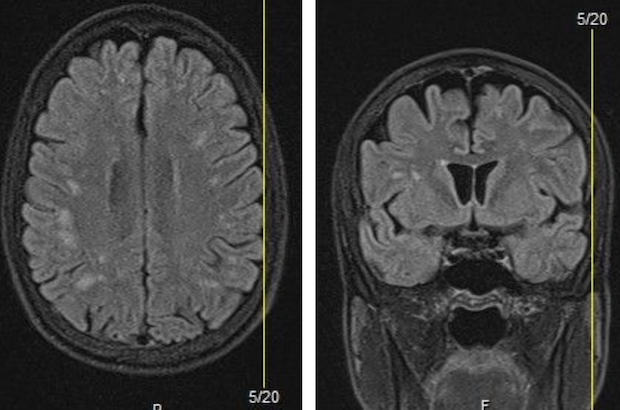 Neuroradiology Case Review - 2025