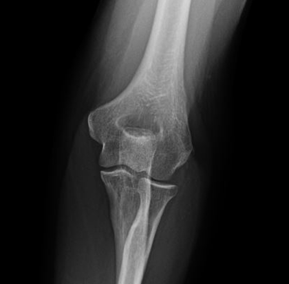 Elbow Orthopedic Assessment