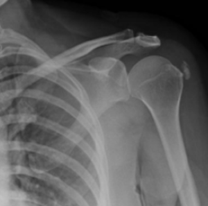 Shoulder Orthopedic Assessment