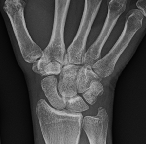 Wrist and Hand Orthopedic Assessment
