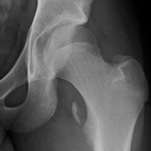 Hip Orthopedic Assessment