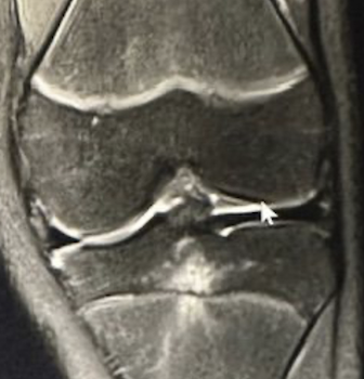 Knee Orthopedic Assessment