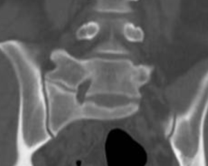 Grand Rounds - Normal X-ray Variants