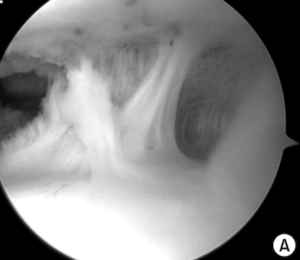 Chiropractic Orthopedics