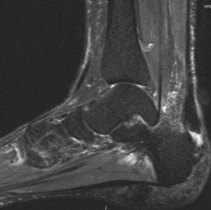 Ankle and Foot Orthopedic Assessment